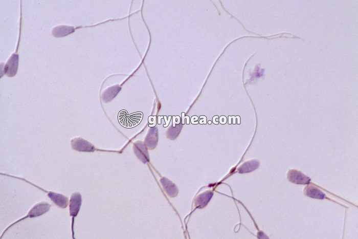 Spermatozoïdes de Taureau x250 - gryphea.com